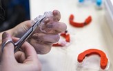 3D Plaklar ile Hastaları Diş Telinden Kurtaran Türk Girişimi: Orthero!